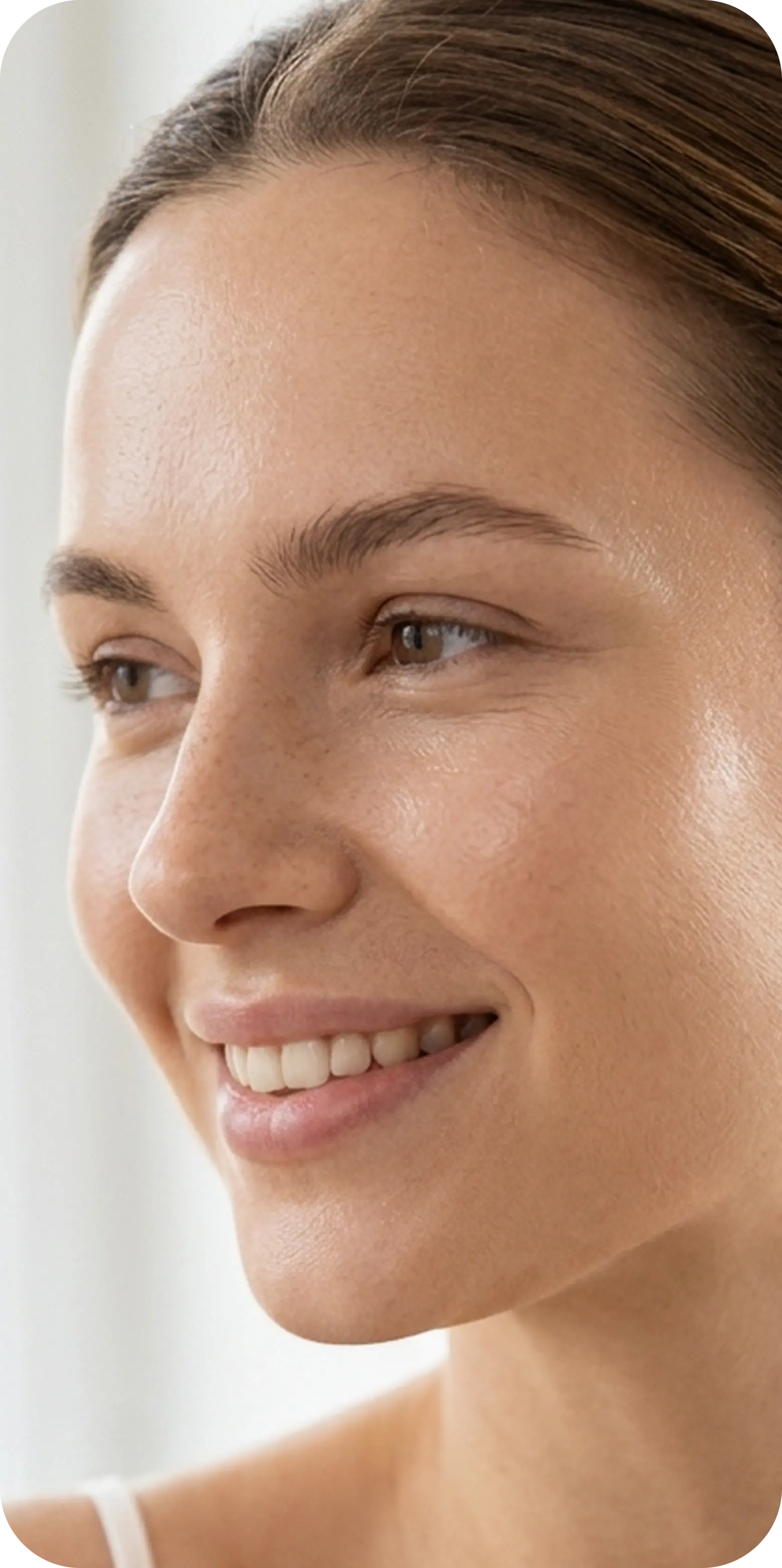 Patient with clear skin after acne treatment