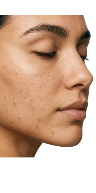 Skin before treatment