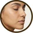 Patient with clearer skin