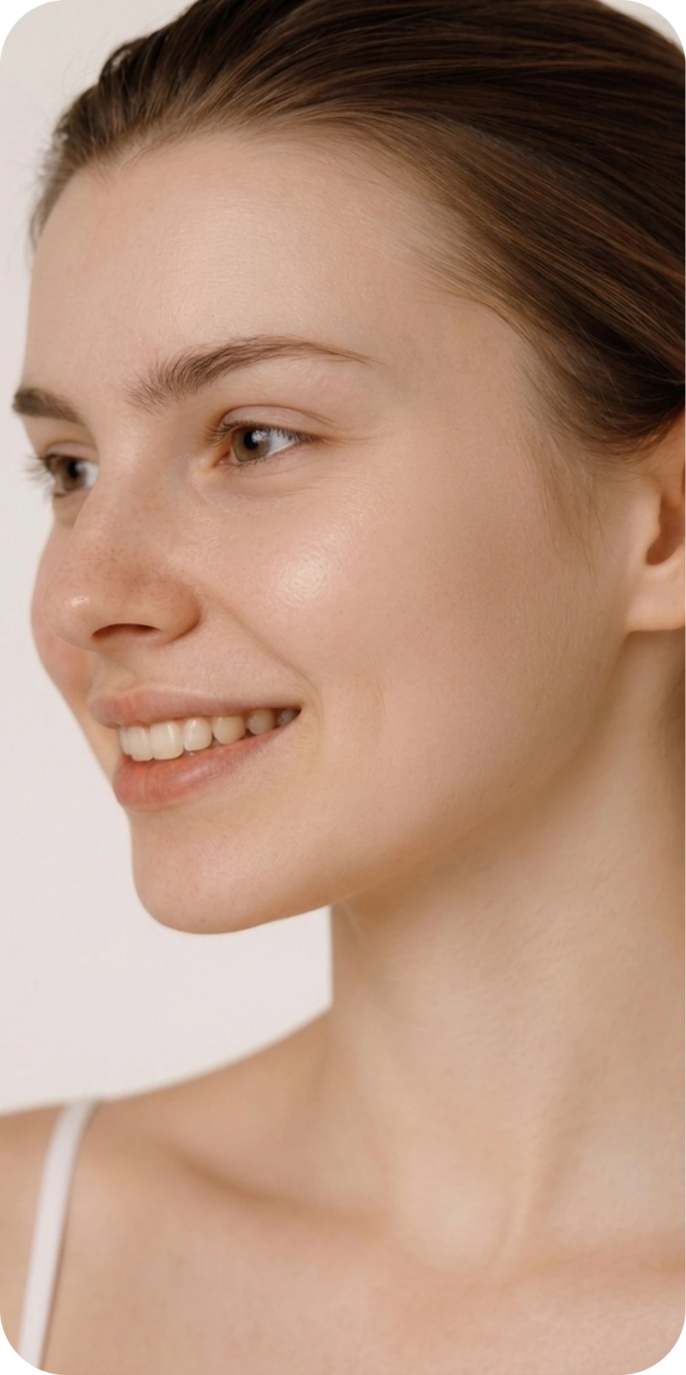 Same patient after treatment with calmer, clearer skin