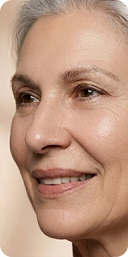 Same patient after treatment with softened lines