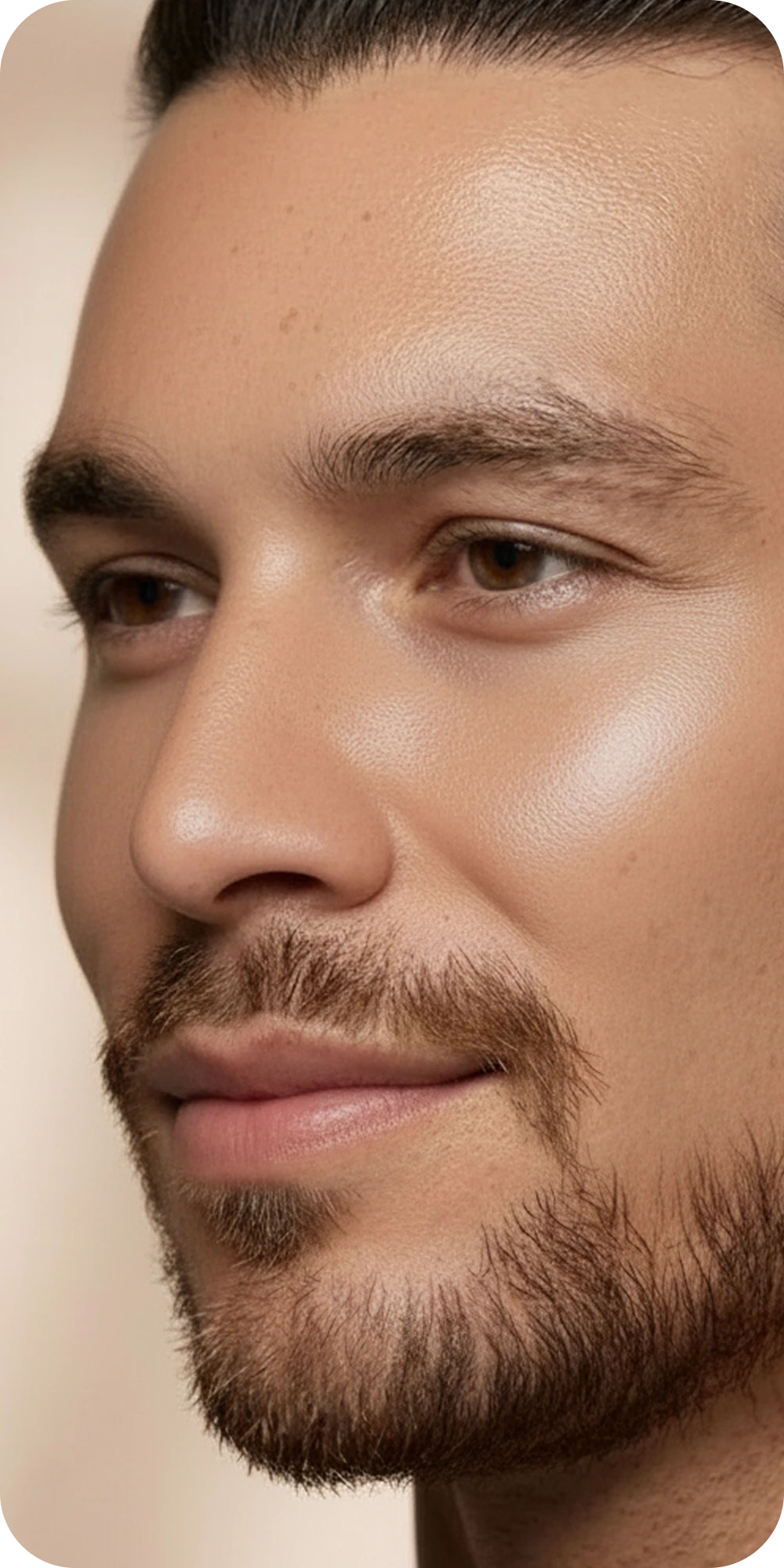 Same patient after treatment with smoother, clearer skin