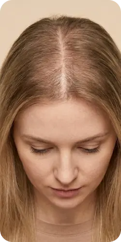 Patient before treatment with reduced fullness